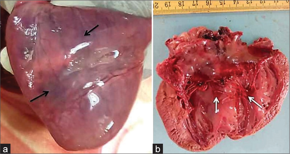 (a) Enlarged heart with epicardial (black arrows), (b) endocardial (white arrows) hemorrhages.