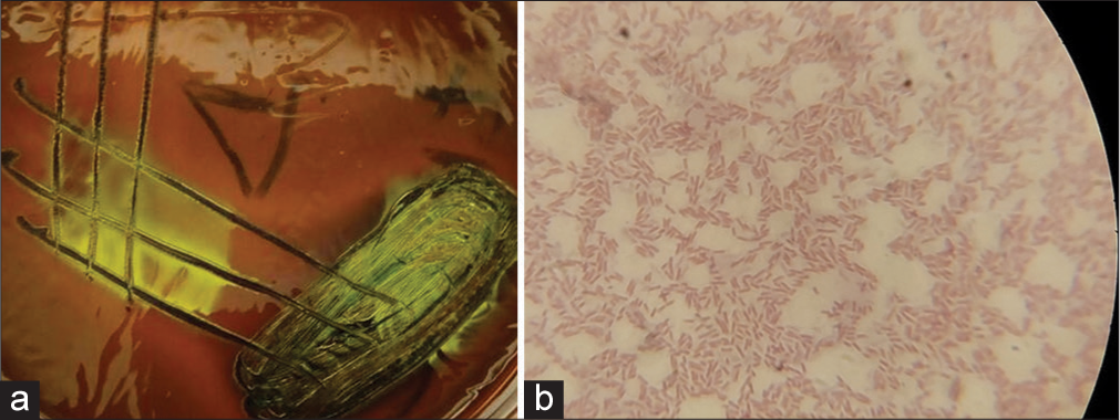 (a) Colonies with greenish metallic sheen on eosin methylene blue agar; and (b) Gram-negative rods, presumptive for Escherichia coli (Grams stain, X100 Magnification).