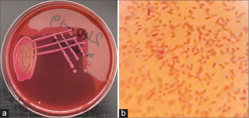 (a) Small size, pink, mucoid colonies on MacConkey agar; and (b) Gram-negative short rods, presumptive for Klebsiella spp (Grams stain, X100 Magnification).