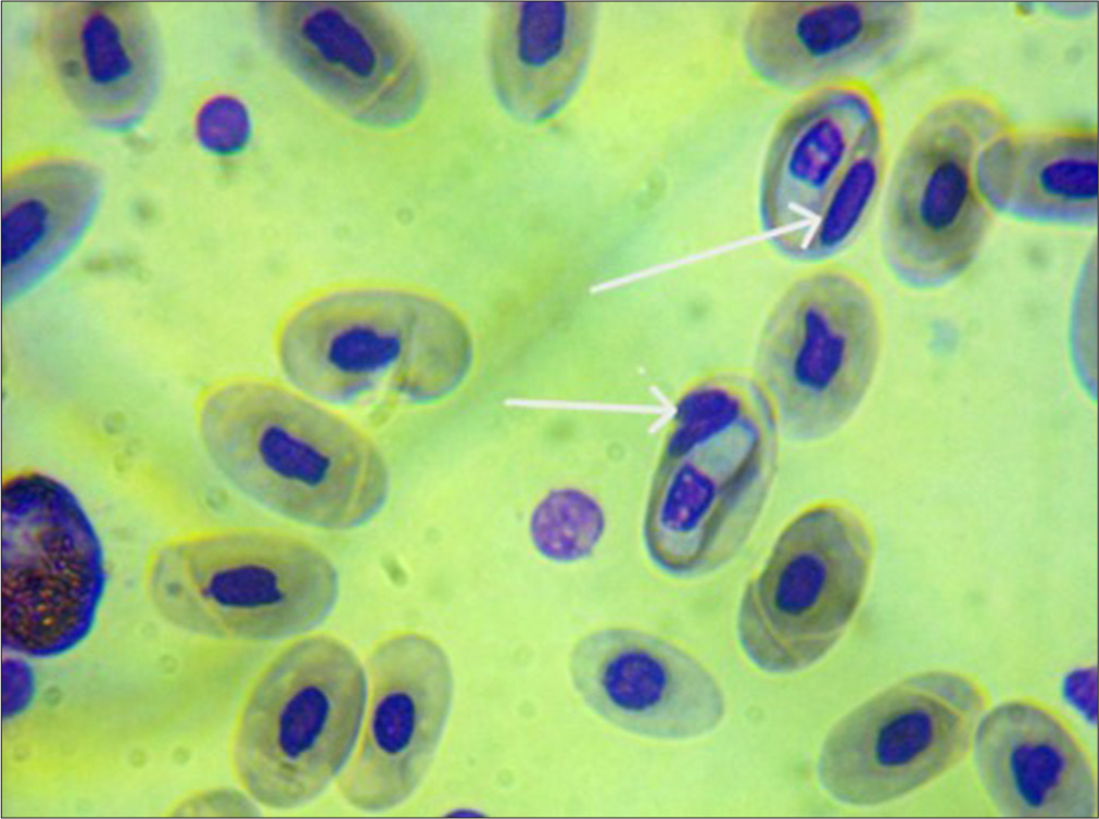 Photomicrograph of thin blood smear of African rock python (Python sebae) showing intraerythrocytic Hepatozoon spp. (white arrows).