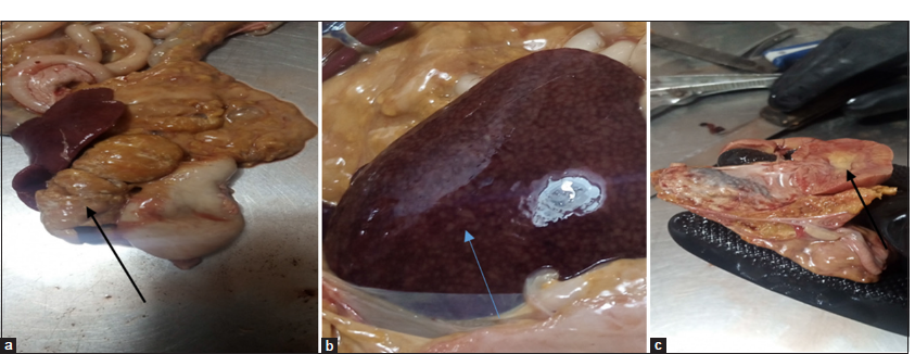 (a) Markedly enlarged and yellowish discolored pancreas (black arrow). (b) The enlarged liver at necropsy showing congestion and widespread subcapsular necrotic foci (blue arrow). (c) Yellowish fat surrounding the kidney (black arrow) and fat deposits within the renal pelvis.