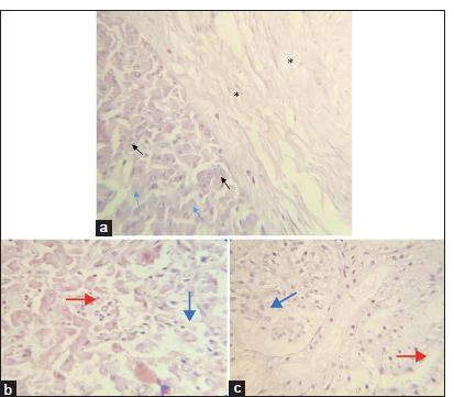 (a) Photomicrograph of the pancreas showing necrosis (blue arrows) and vacuolation (black arrows) of the pancreatic cells, with widespread fibrous connective tissue deposition (black asterisk) and mononuclear cell infiltration (H&E ×400). (b) Photomicrograph of the liver showing necrosis of hepatocytes and mononuclear cellular infiltration (hematoxylin and eosin [H&E] ×400) mononuclear cellular infiltration (red arrow), necrosis of hepatocytes (blue arrow) (c) Photomicrograph of the kidney showing widespread necrosis and vacuolation of renal tubular epithelial cells (blue arrows), with vacuoles in the lumen of the convoluted tubules and collecting ducts (red arrow).